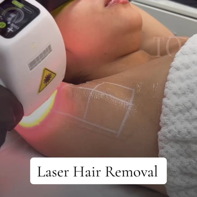 Laser Hair Removal at Flow Ink & Beauty in Henderson, NV